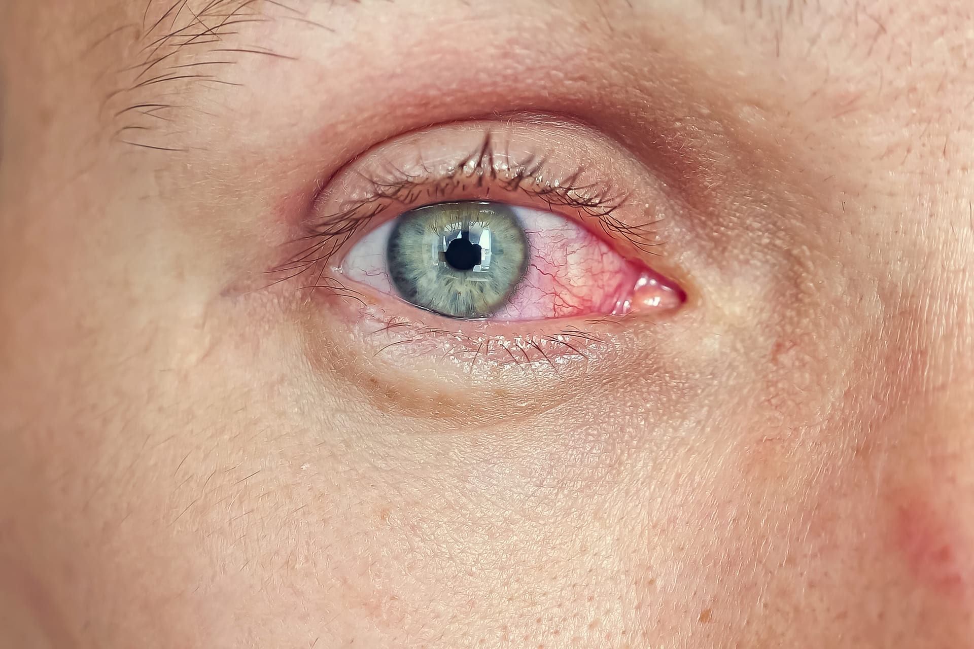 Mulher sentindo desconforto nos olhos durante o inverno seco